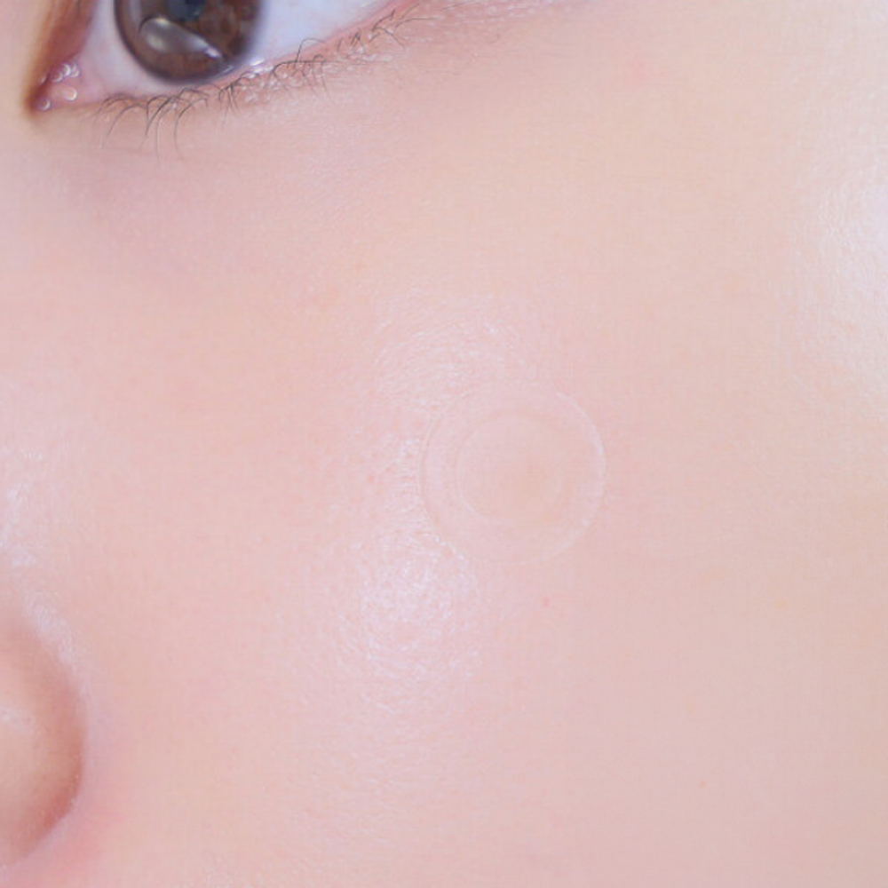 Scar Cover Spot Patch